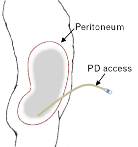 PD access diagram